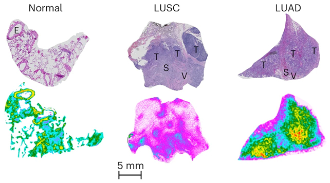Lung tissue image